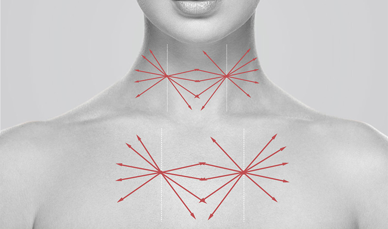 Точки введения RRS® HA Long Lasting