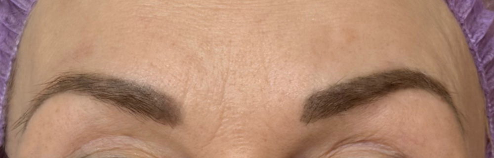 Light Fit NMN и Light Fit PDRN+