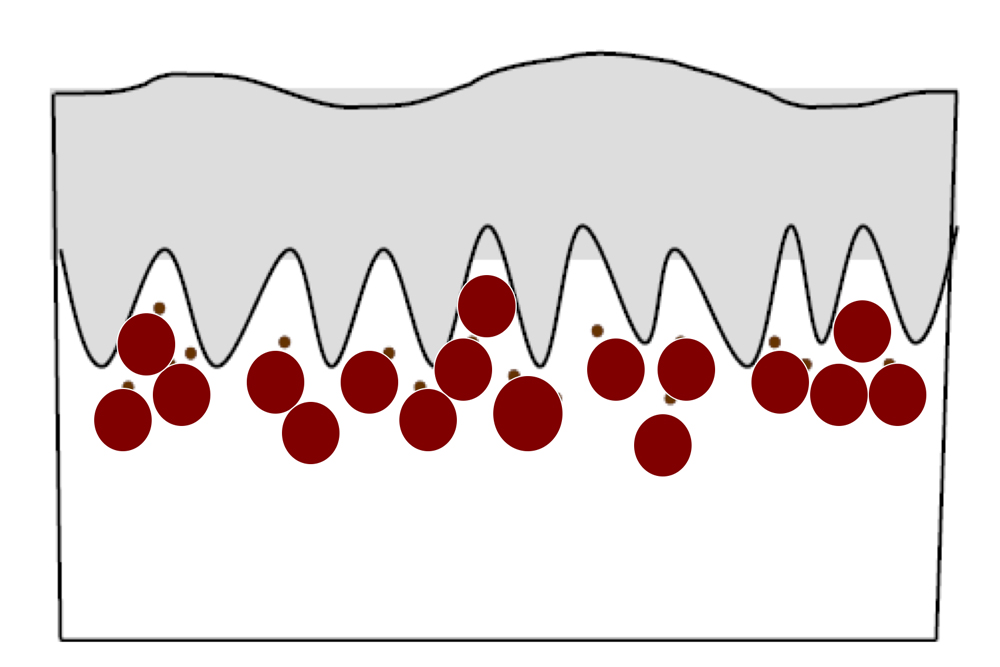 Исходная ситуация: крупные участки пигмента дермы