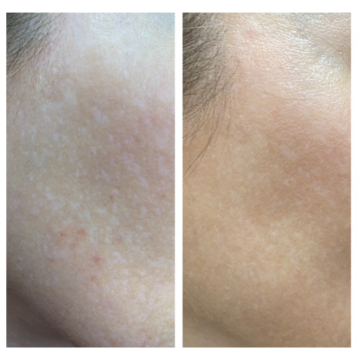 Клинический случай 1