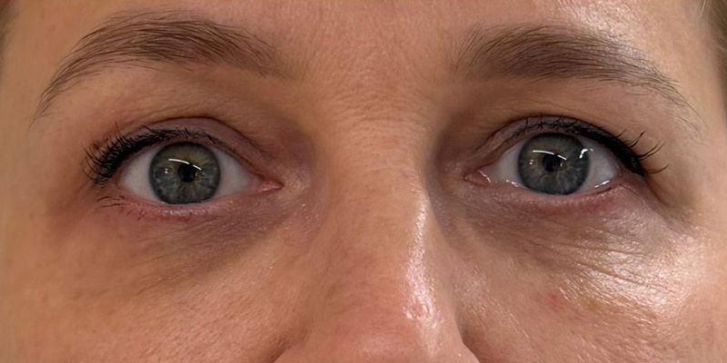 фракционный термолиз на аппарате CAPELLO CO2 Re:Flex, фото после