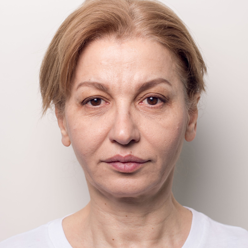 Алла, 32 года. Фото после