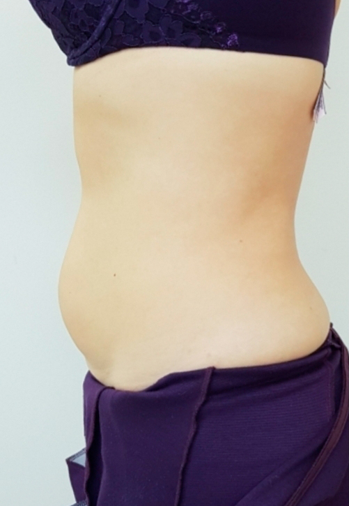 ulfit фото до