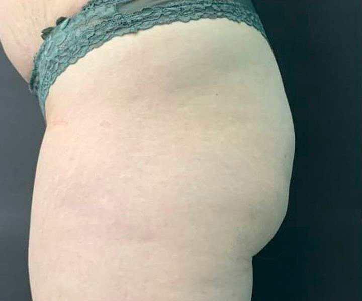 Virtue, результат