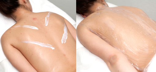 Easy Phytic Peel