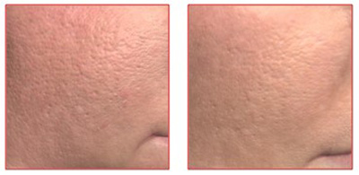 Ксеомин, исследование