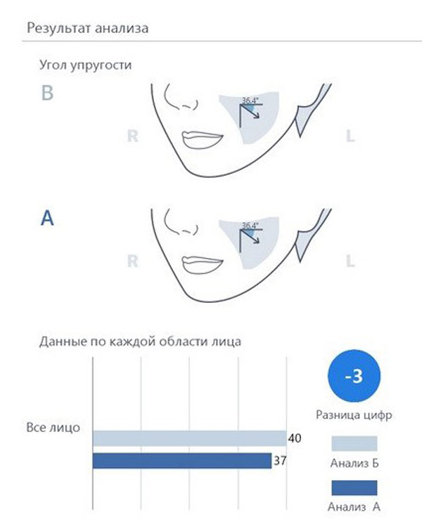 Calecim Professional Serum