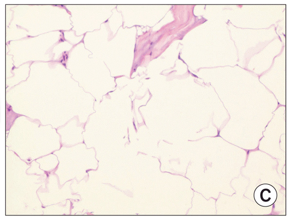 ядерная фрагментация между адипоцитами