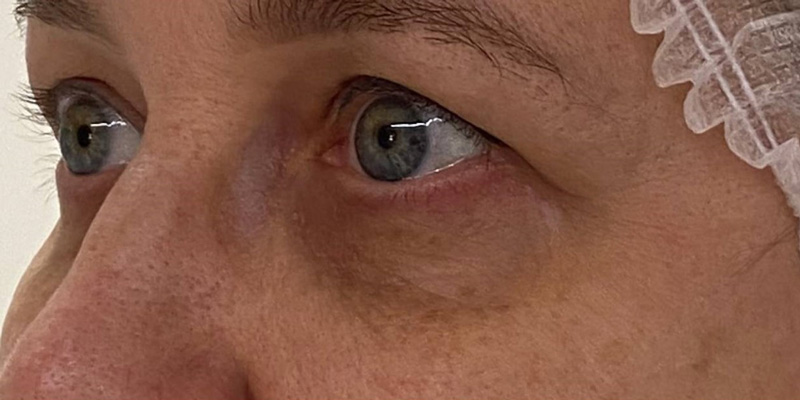 фракционный термолиз на аппарате CAPELLO CO2 Re:Flex, фото до