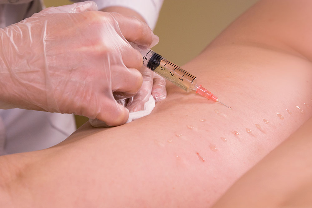 Введение препаратов Репарестим ГК ТД и Силоргамин