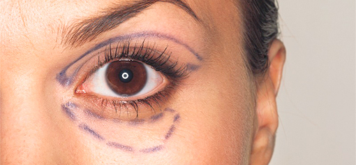 Популярные пластические операции на лице