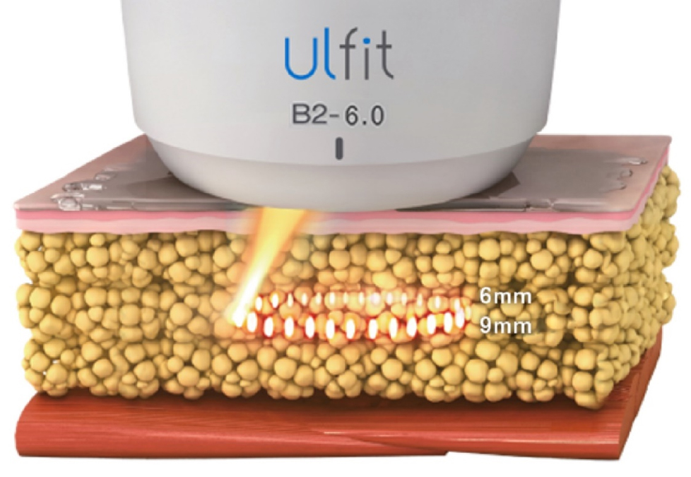ulfit
