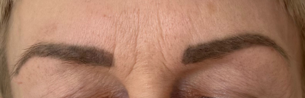 Light Fit NMN и Light Fit PDRN+