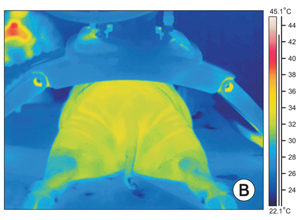 Инфракрасные тепловые изображения до радиочастотной обработки