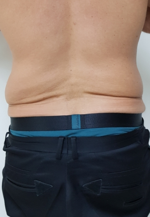 ulfit фото до