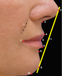 линии Риккетса, красивая улыбка