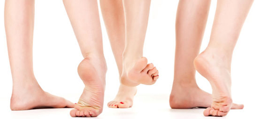 Hallux valgus