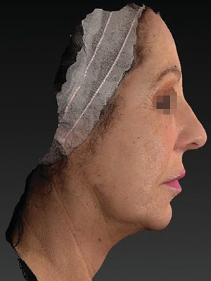 Косая и боковая проекции лица