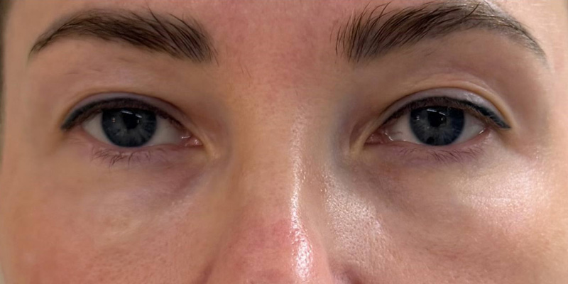 фракционный термолиз на аппарате CAPELLO CO2 Re:Flex, фото после