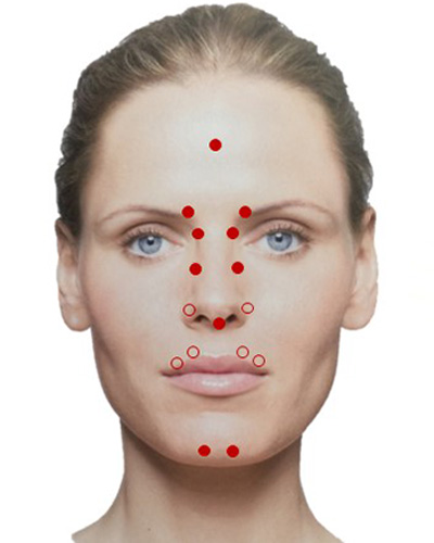 Разведение Ксеомина