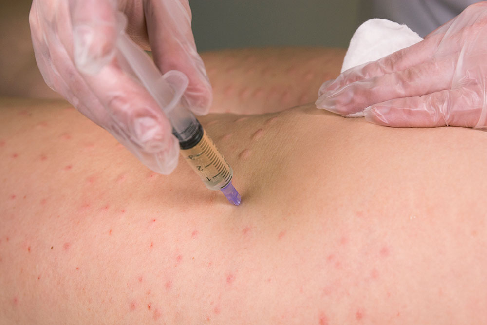 Введение препарата