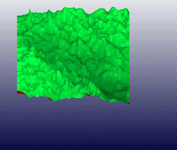 поверхность кожи после проведения инъекционного курса АЗТ Jalupro®