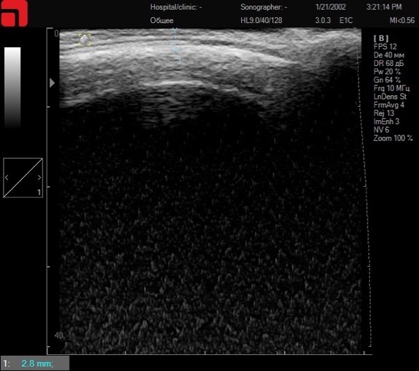 Сканирование области лба