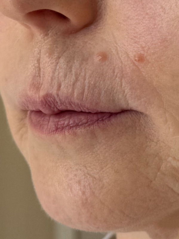 Light Fit NMN и Light Fit PDRN+