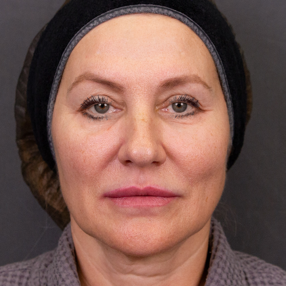 Клинический случай, Протокол Skin Glow