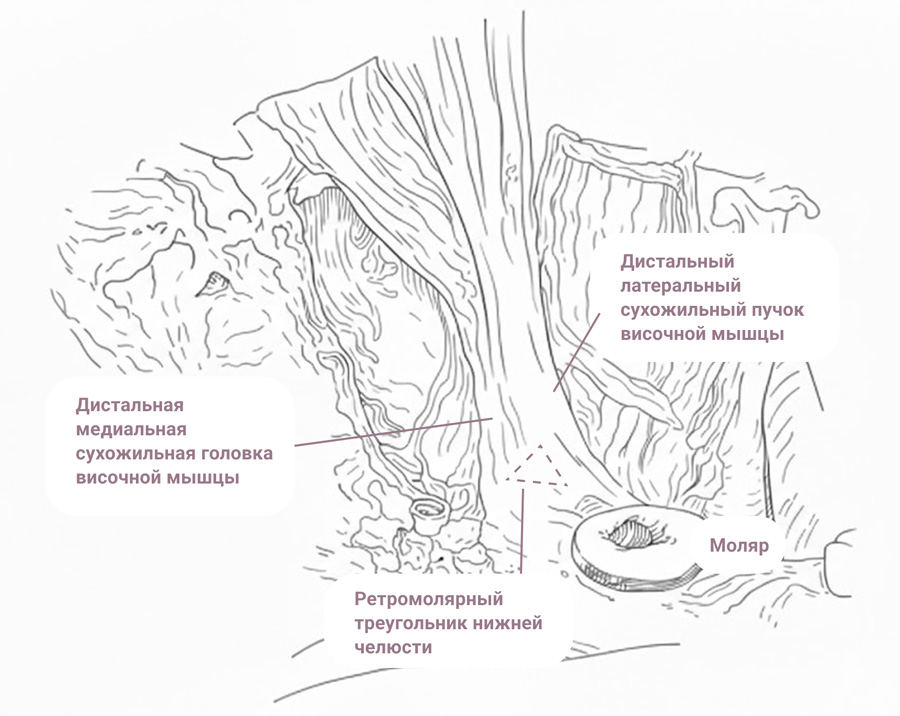Контроверсии вокруг m. temporalis