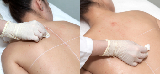 Easy Phytic Peel