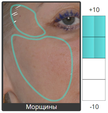 Протокол процедуры Peach Peel PRO и Colibriderm Hydro, фото до