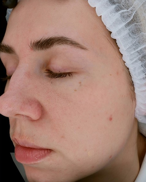 Calecim Professional Serum