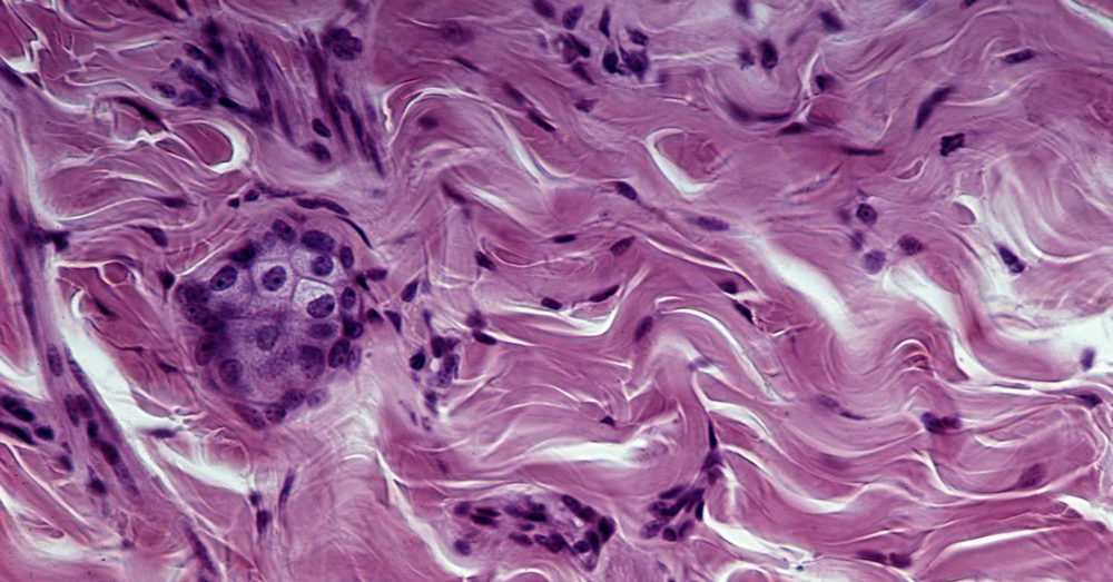 Стволовые клетки и белковые функции кожи