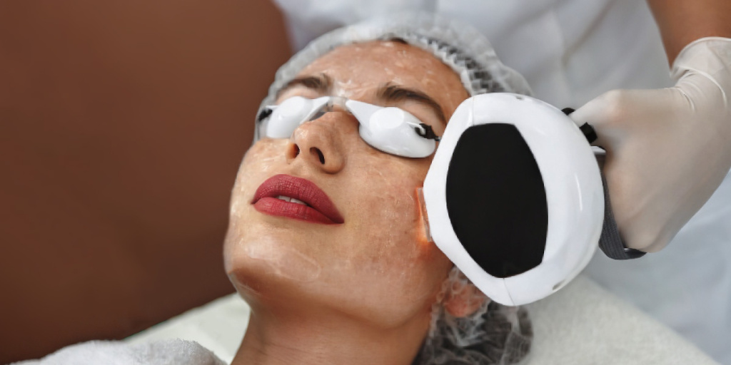 Азбука гиперпигментации, Аппаратные технологии