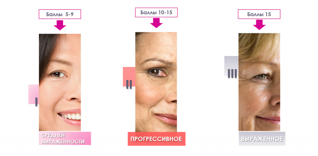 Степень выраженности старения