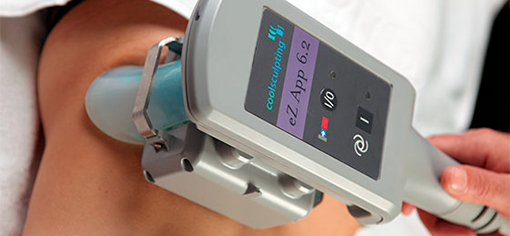 Coolsculpting® 