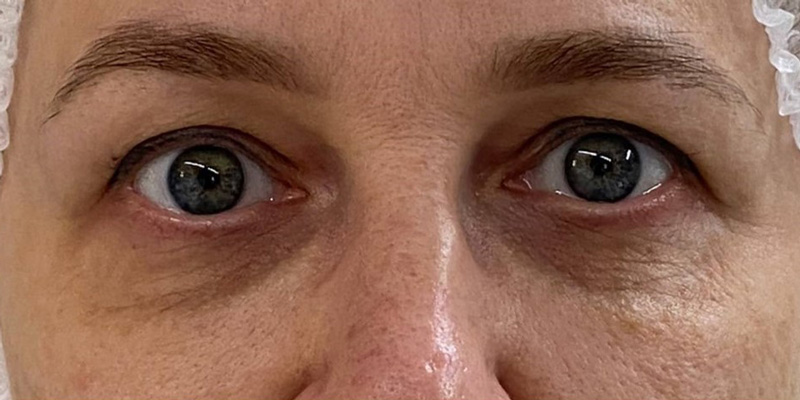 фракционный термолиз на аппарате CAPELLO CO2 Re:Flex, фото до