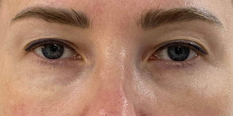 фракционный термолиз на аппарате CAPELLO CO2 Re:Flex, фото до