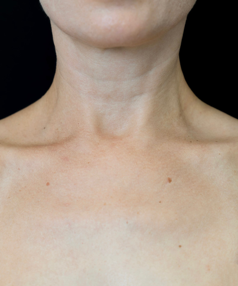 Bio-expander