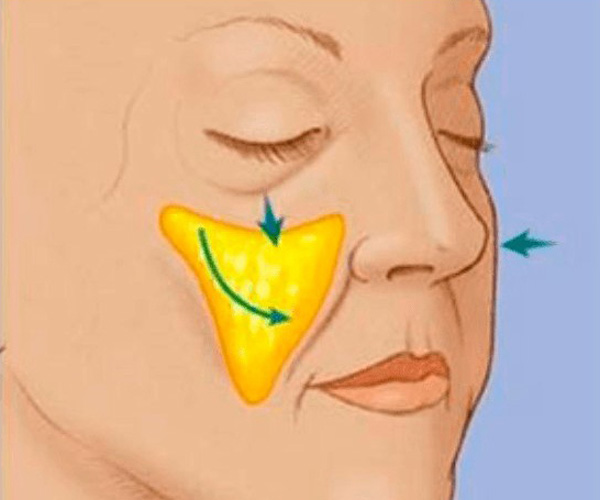 Малярные мешки