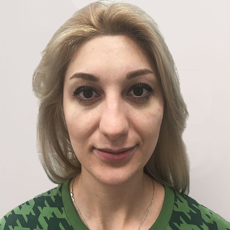 Алла, 32 года. Фото до