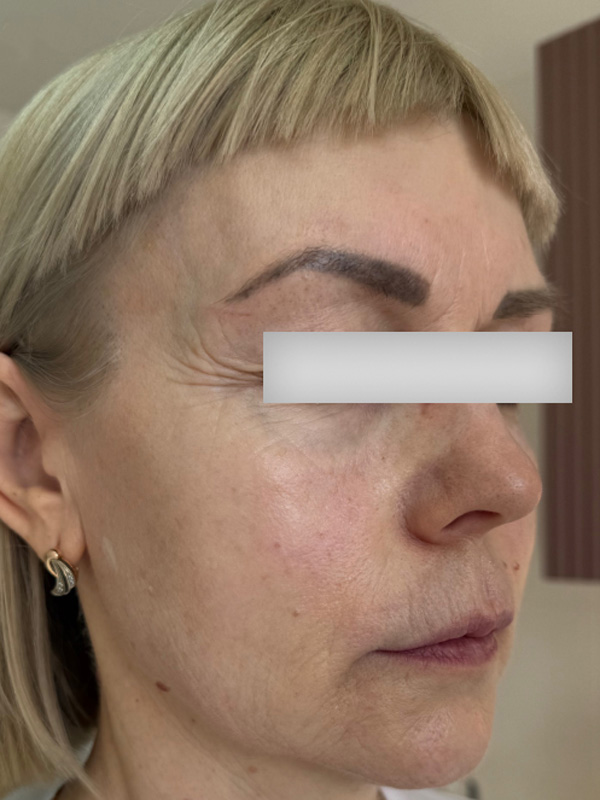 Light Fit NMN и Light Fit PDRN+