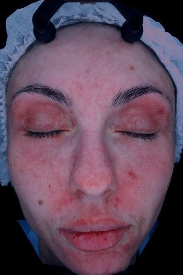 Calecim Professional Serum