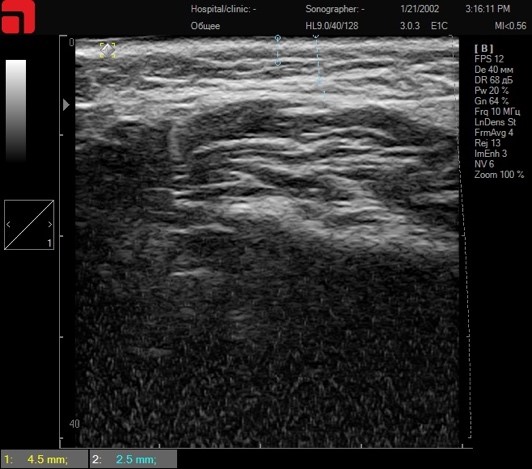 Сканирование щечной области