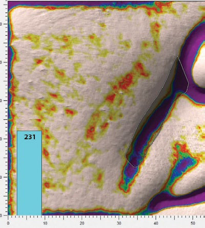 Морщины на 3D-снимках