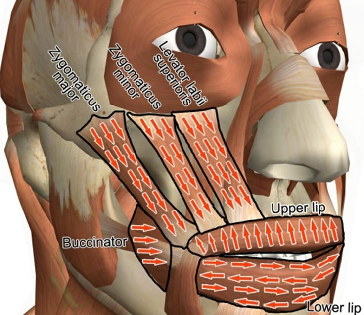 Направления проходов лазером при выполнении SmoothLifting