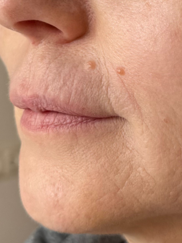 Light Fit NMN и Light Fit PDRN+