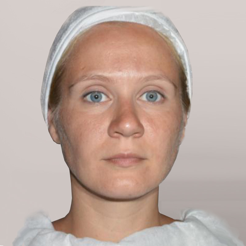 Ольга, 28 лет. Фото до