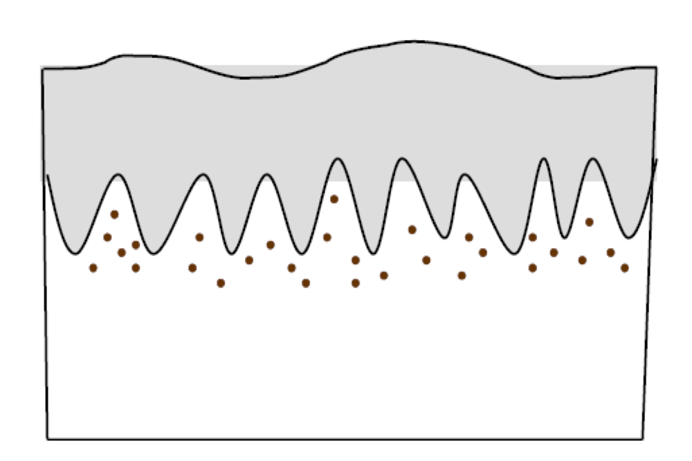 Непосредственно после терапии: пигмент распадается на мелкие части